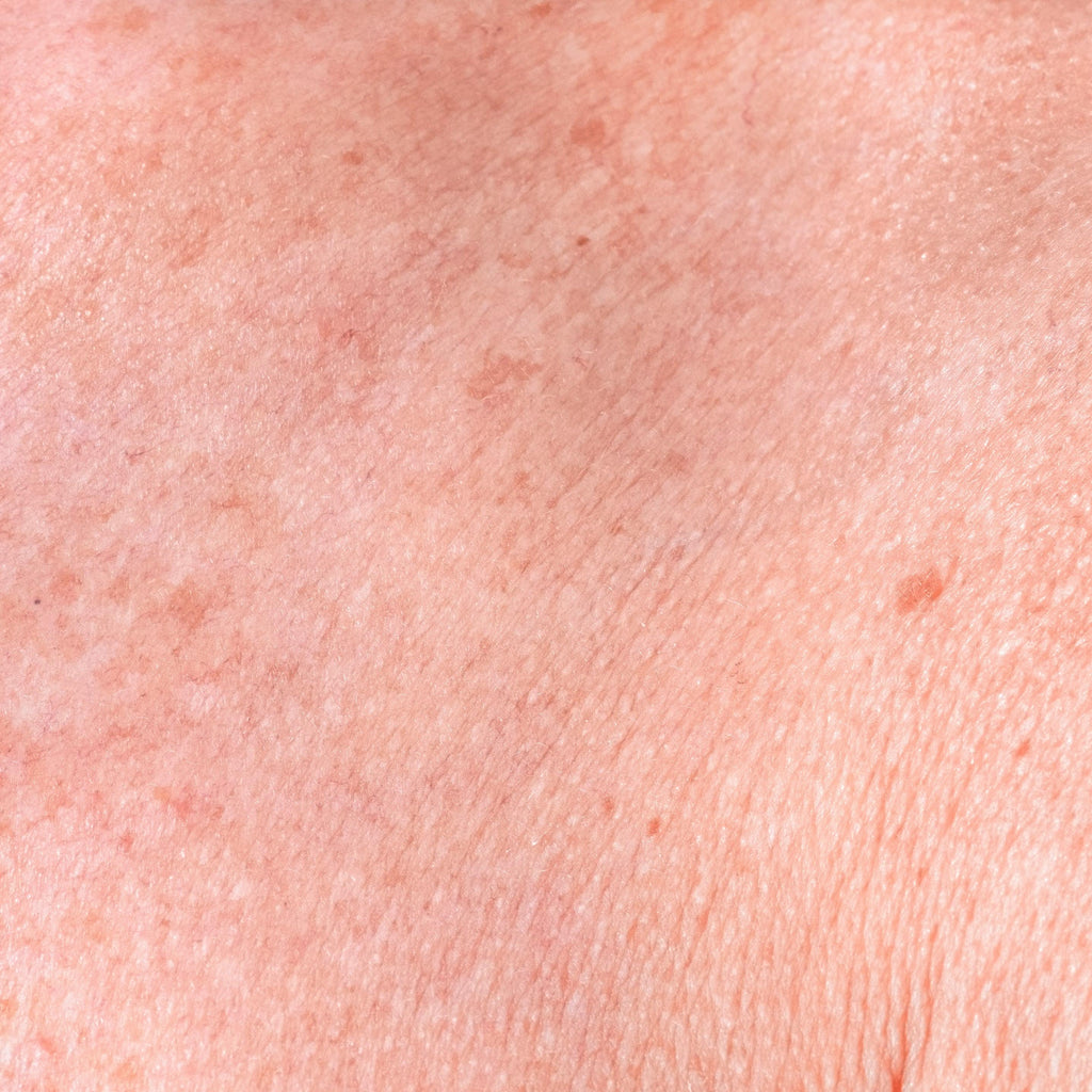 Inflammerad hud – En berättelse om Inflammatoriska Cytokiner och endocannabinoider - 1753 SKINCARE